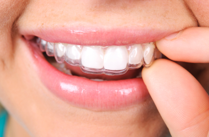 iStock_000019898070_ExtraSmall.jpg