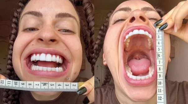 big mouth.jpg