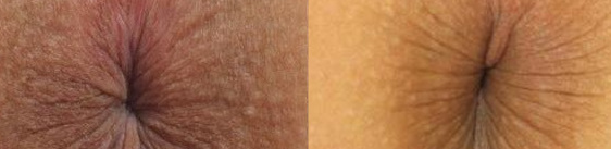 which-one-is-the female-one2.JPG